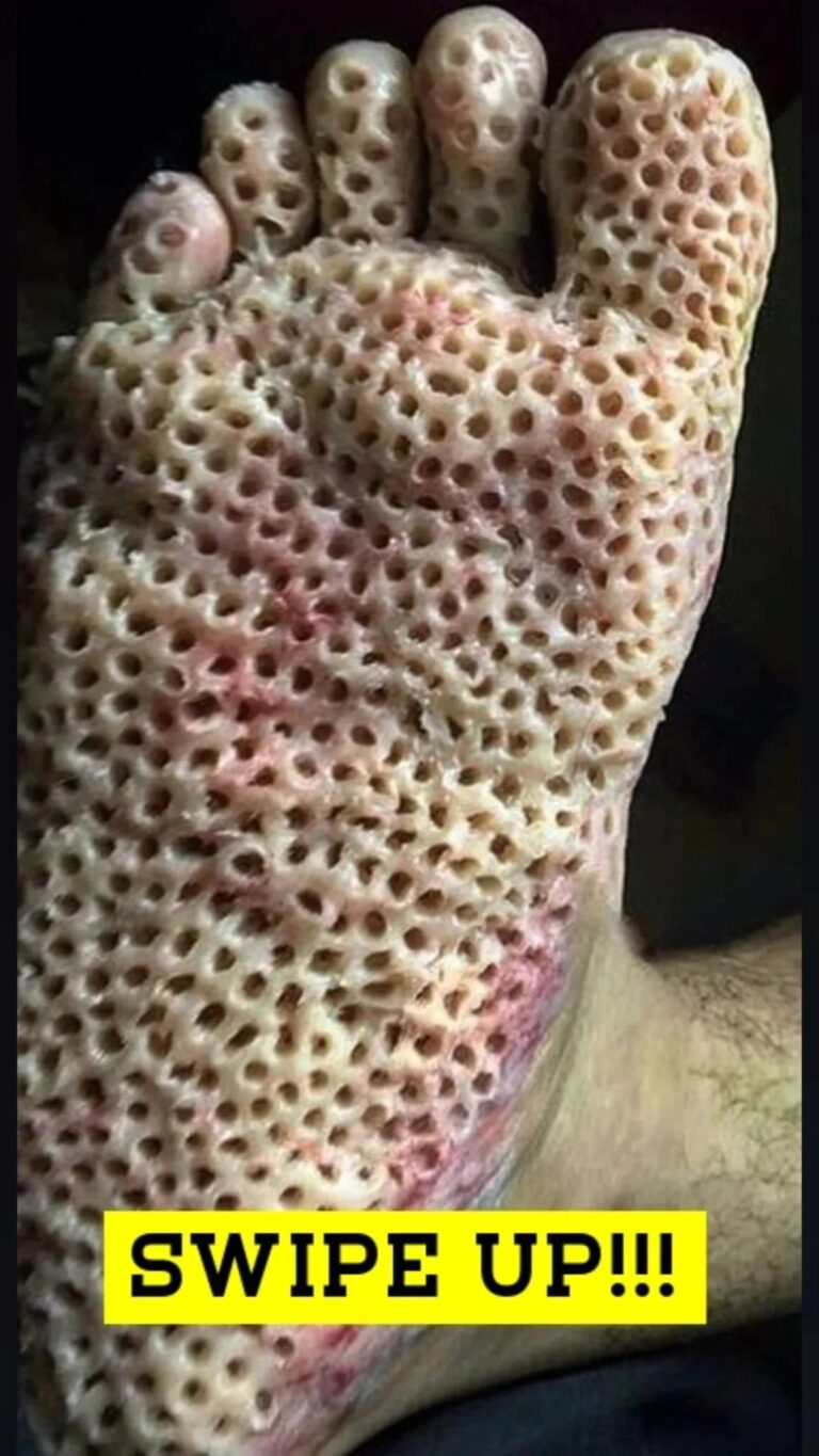 TRYPOPHOBIA!