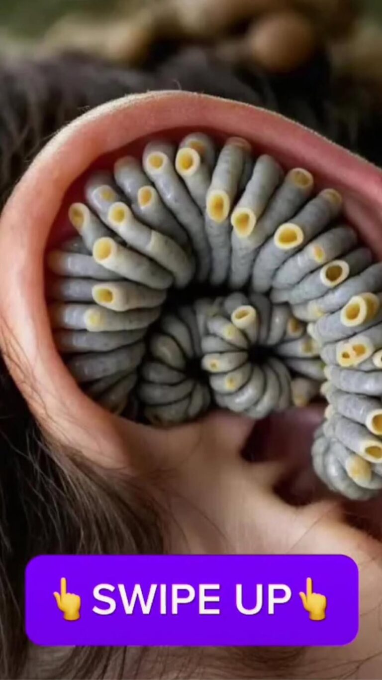 Signs and Prevention Tips for Adult Ear Infections